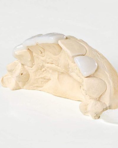 Licowki-porcelanowe-p7ngsh4oi476c9kwdpeozsav9mcllprrukw0u1nclk