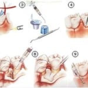PERIODONTOLOGIA